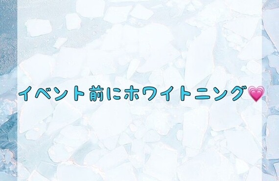 【イベント前にホワイトニング💗】