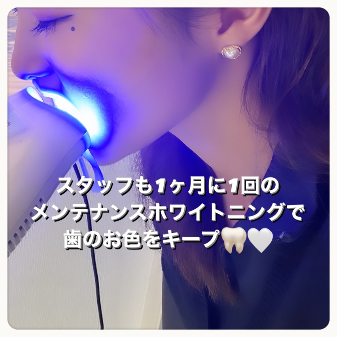 ダウンロード (10)