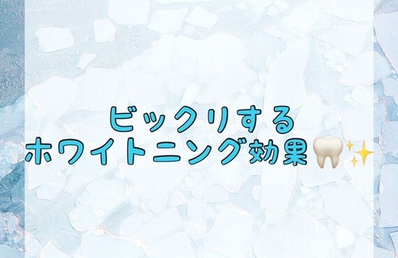 【ビックリするホワイトニング効果🦷✨】