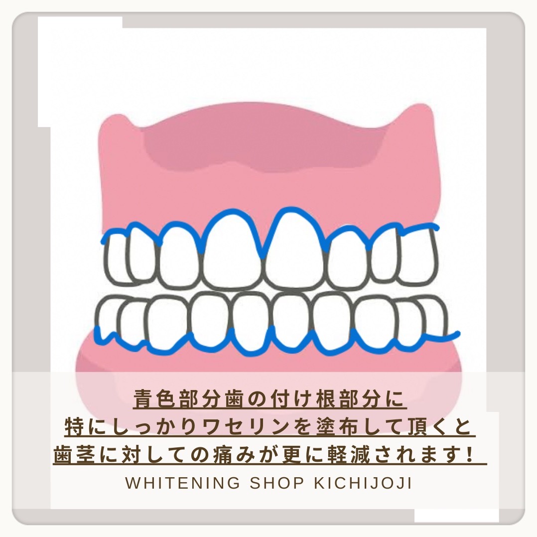 ダウンロード (10)