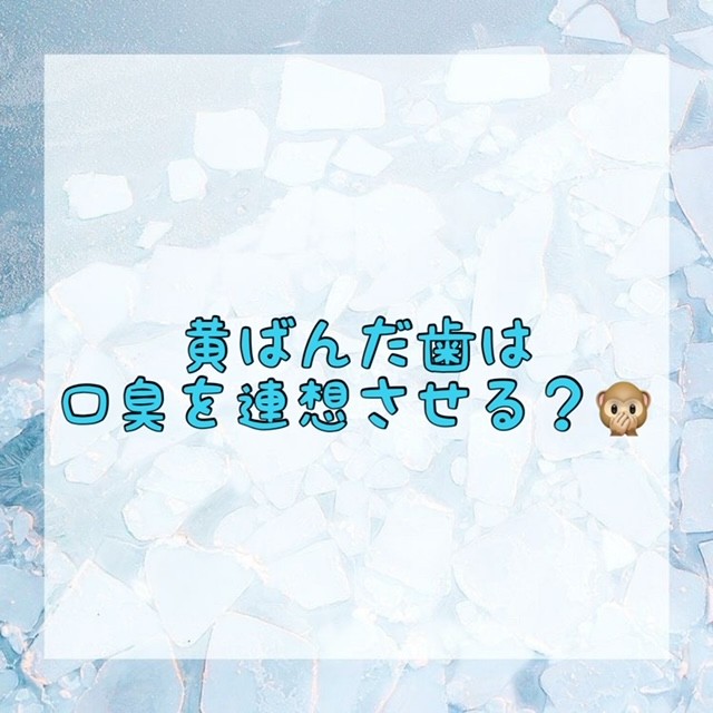 ダウンロード (10)