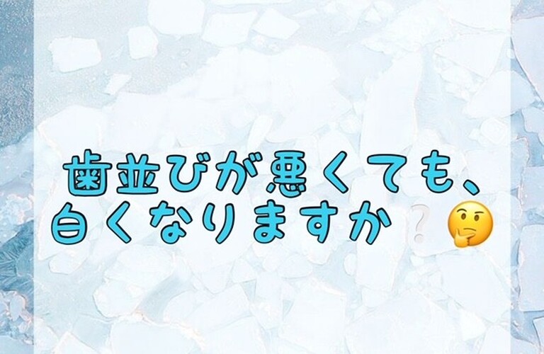 【歯並びが悪くても、白くなりますか❔🤔】