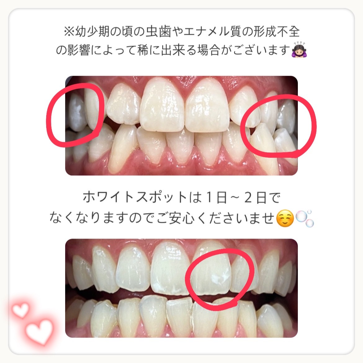 ダウンロード (10)
