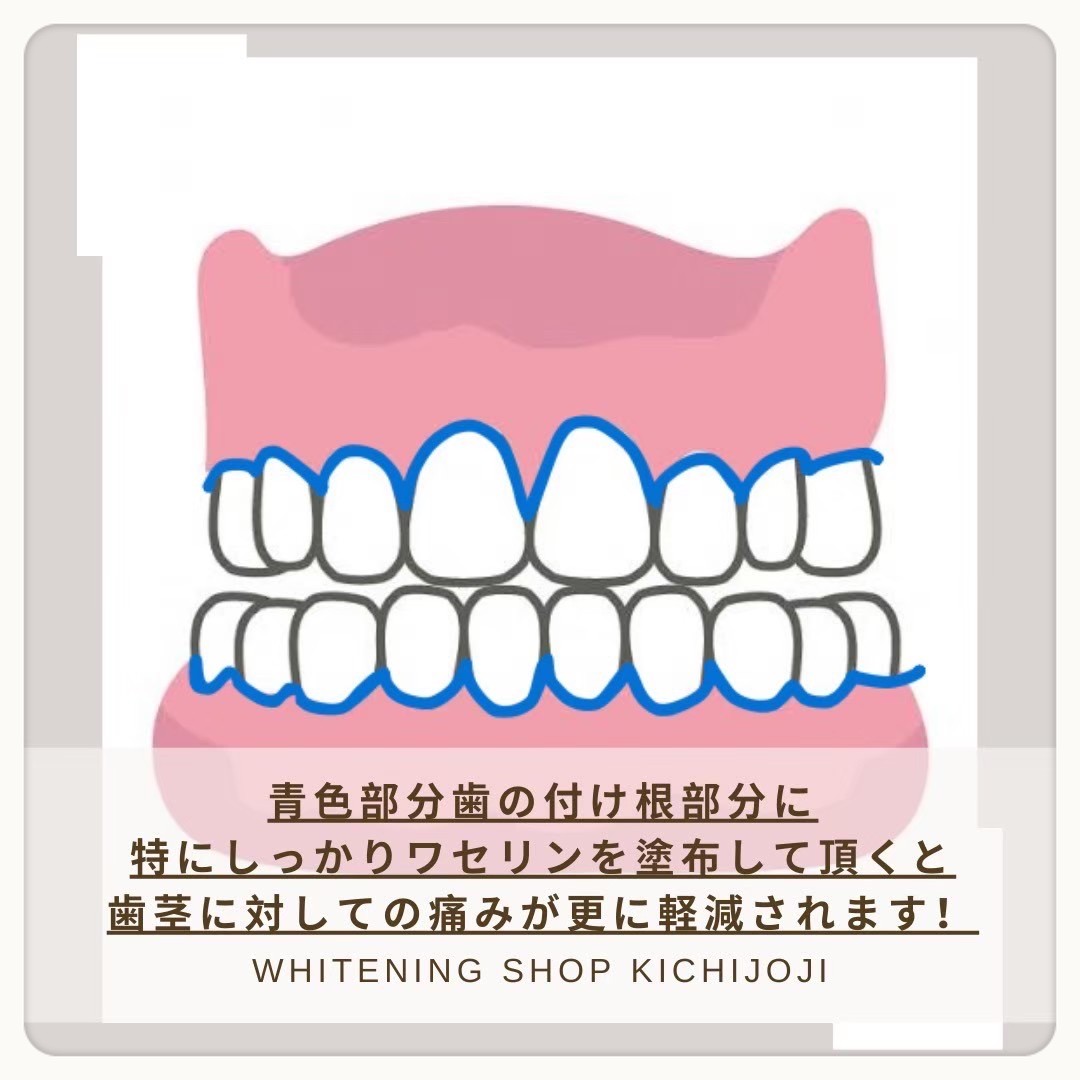 ダウンロード (10)