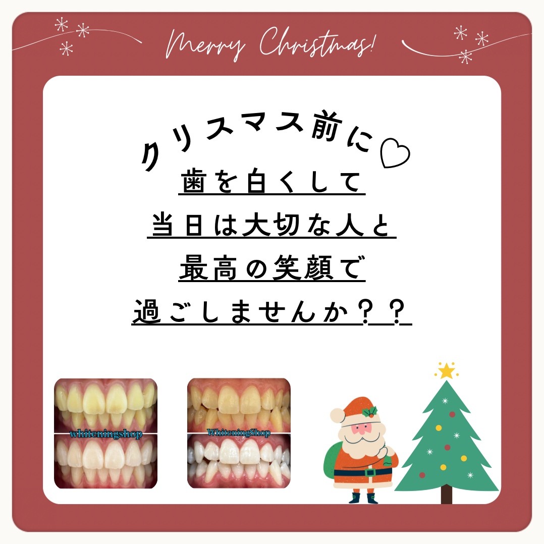 ダウンロード (10)