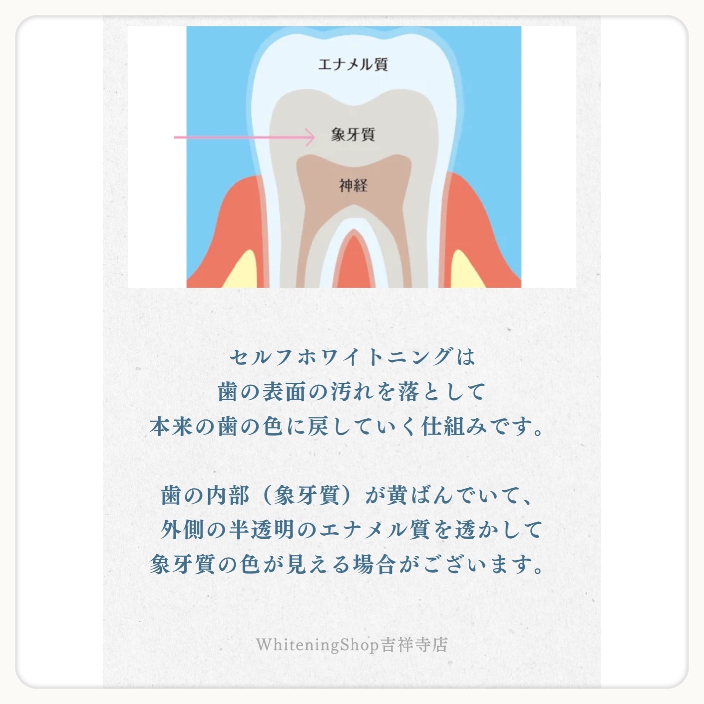ダウンロード (10)