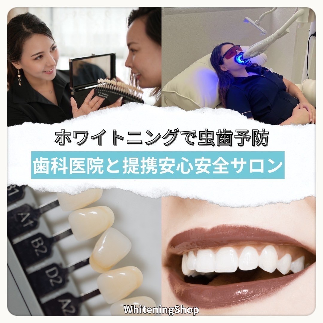 ダウンロード (10)