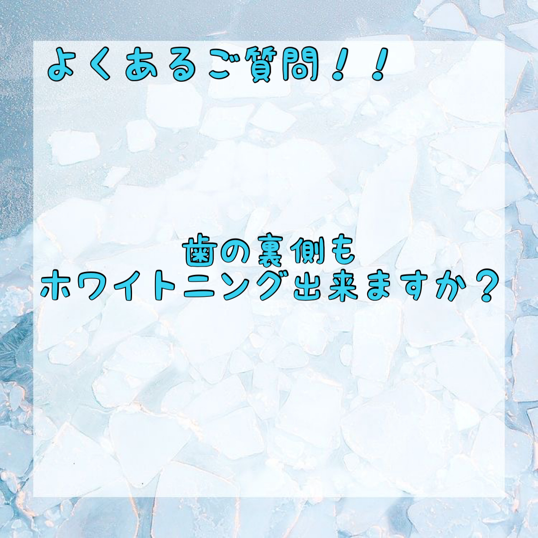 ダウンロード (10)