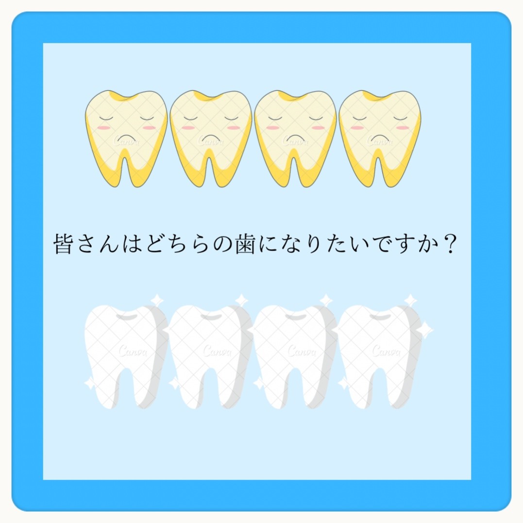 ダウンロード (10)