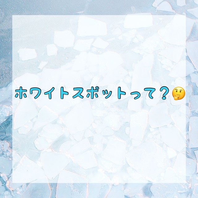 ダウンロード (10)