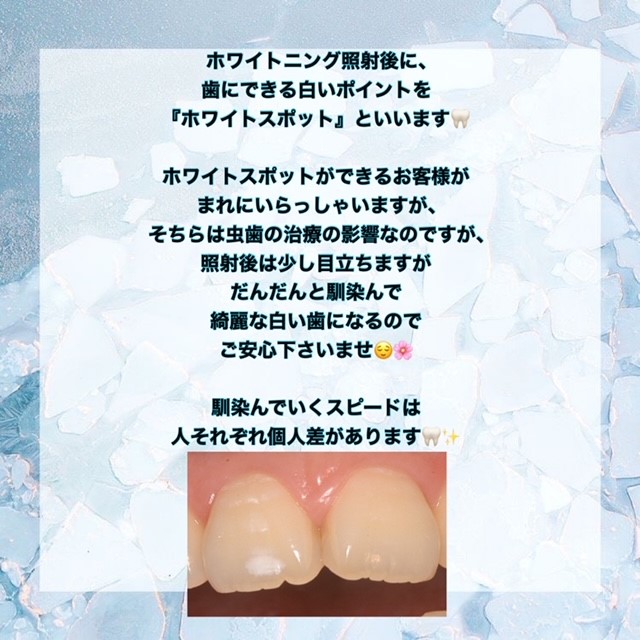 ダウンロード (7)