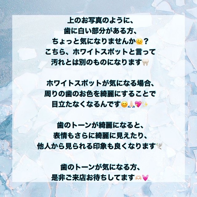 ダウンロード (7)
