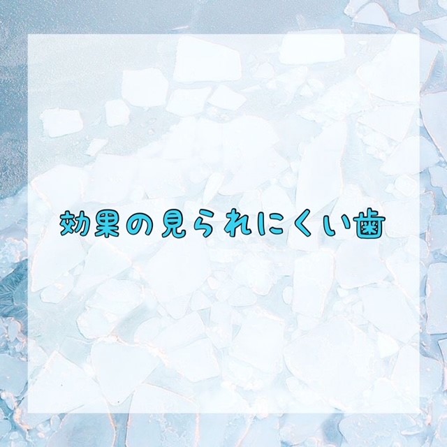 ダウンロード (10)