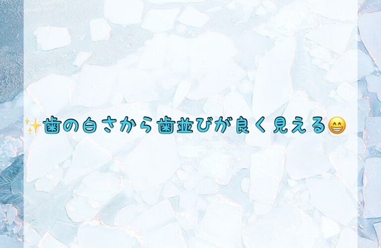 ✨歯の白さから歯並びが良く見える😁