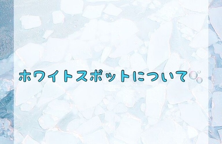 【ホワイトスポットについて✨】