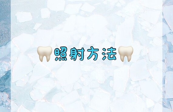 照射方法