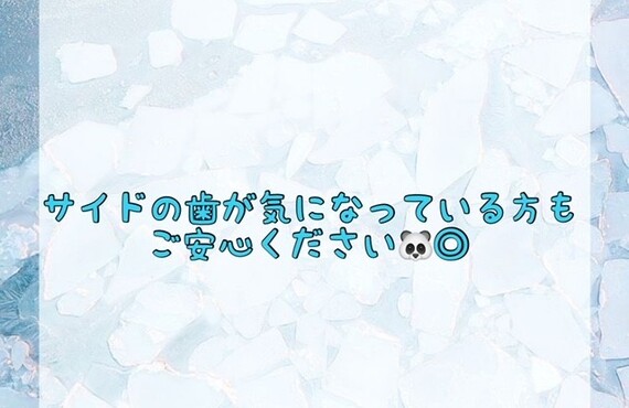 【サイドの歯が気になっている方もご安心ください🐼◎】