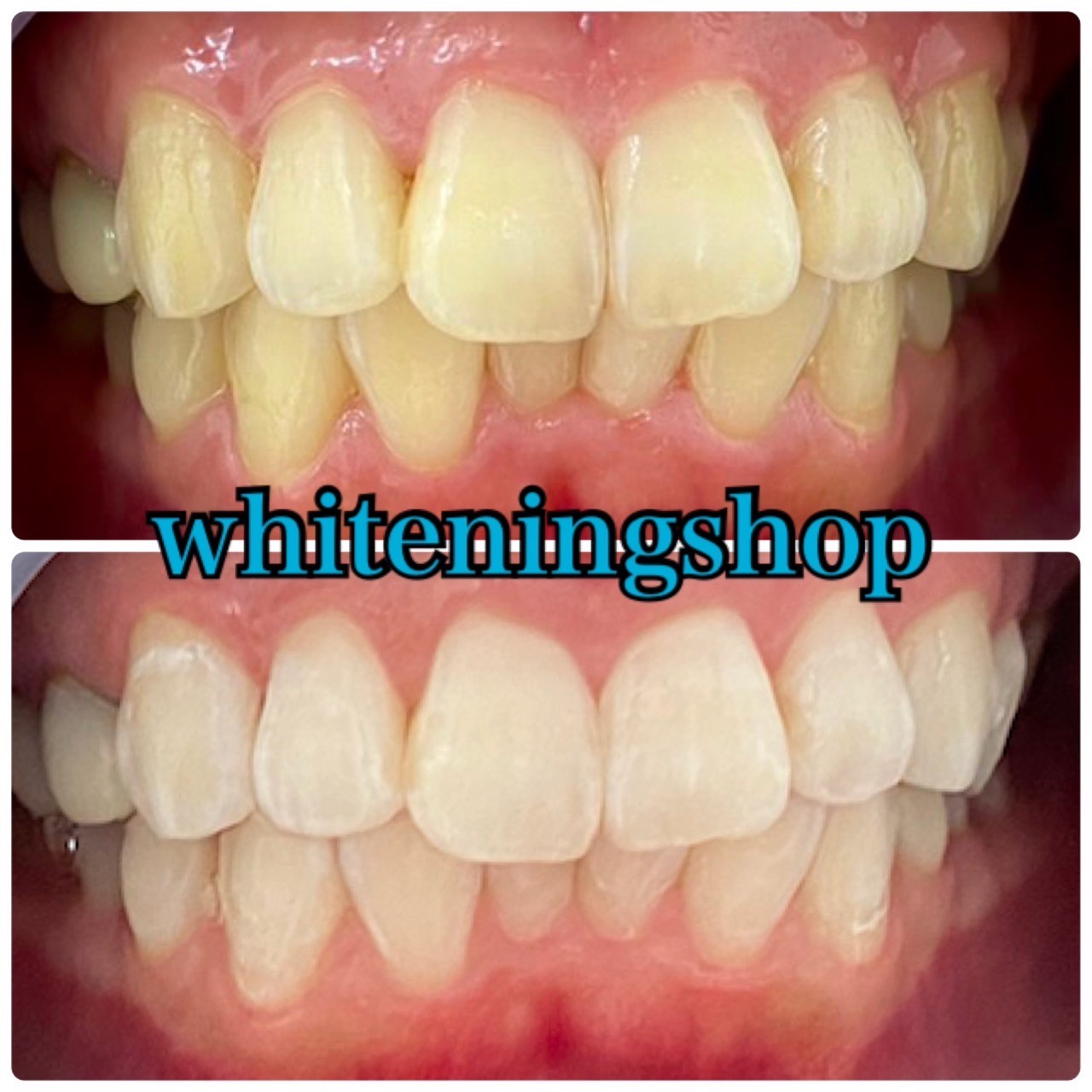 ダウンロード (7)