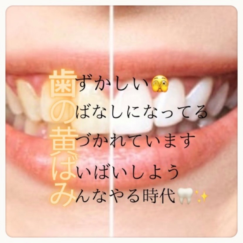 ダウンロード (7)