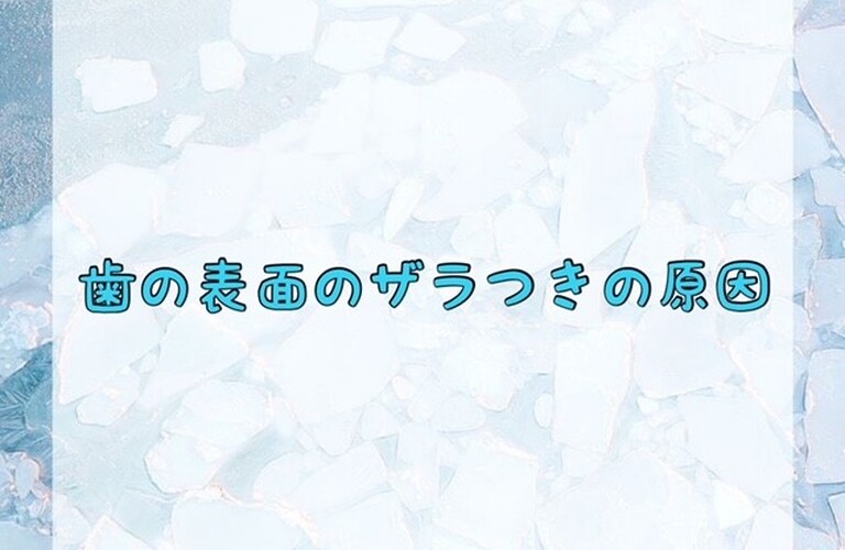 歯の表面のザラつきの原因