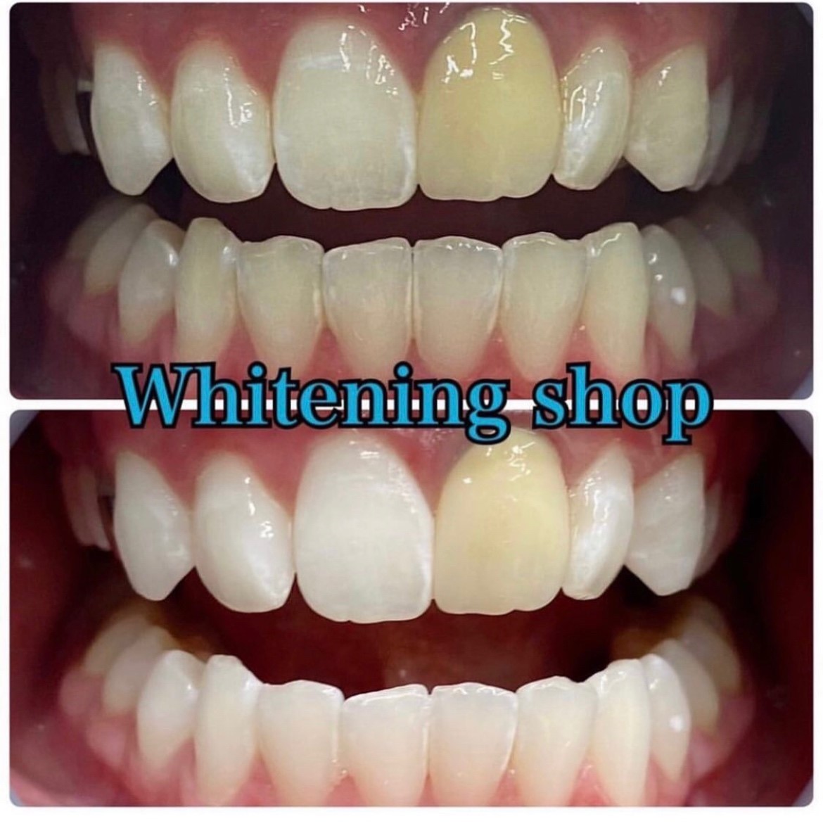 ダウンロード (7)