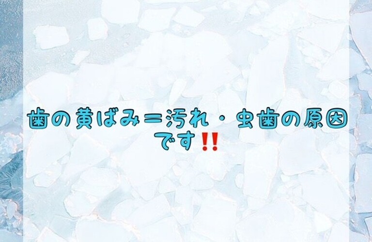 【歯の黄ばみ＝汚れ・虫歯の原因 です‼️】