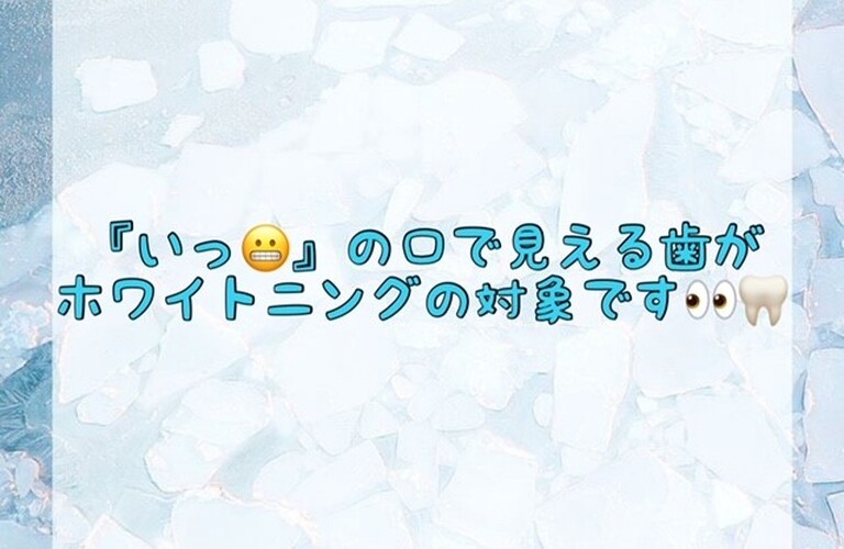 【『いっ😬』の口で見える歯がホワイトニングの対象です👀🦷✨】