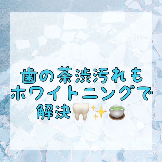 ダウンロード (10)