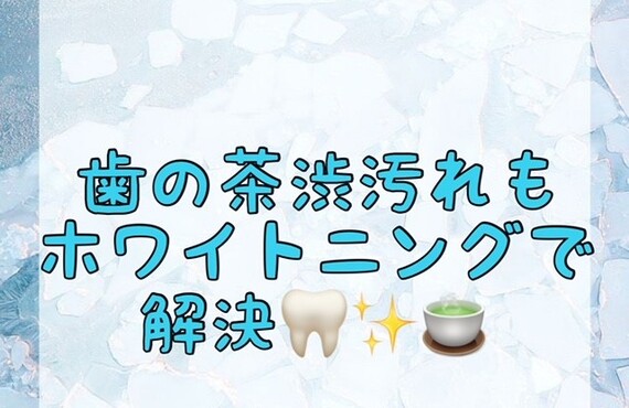 【歯の茶渋汚れもホワイトニングで解決🦷✨🍵】