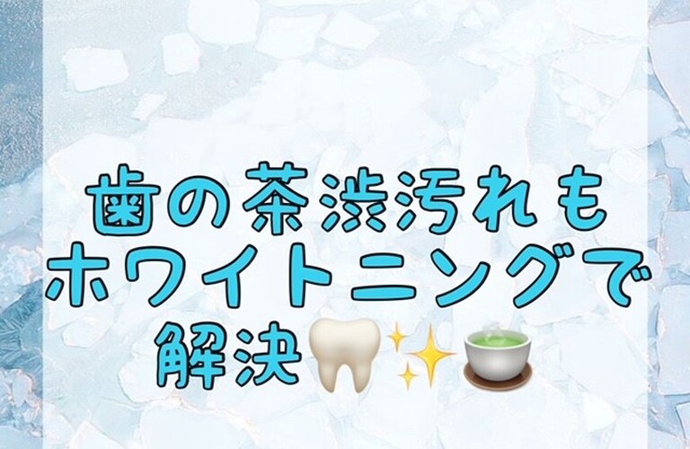 【歯の茶渋汚れもホワイトニングで解決🦷✨🍵】