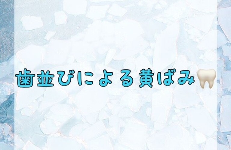 【歯並びによる黄ばみ🦷】
