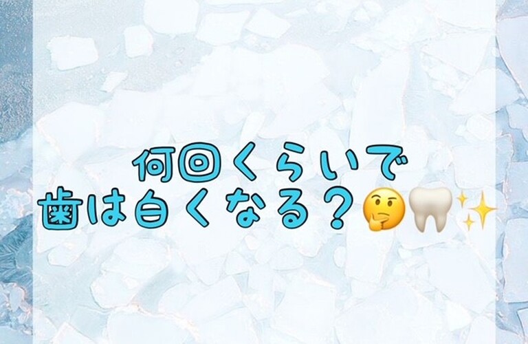 【何回くらいで歯は白くなる？🤔🦷✨】