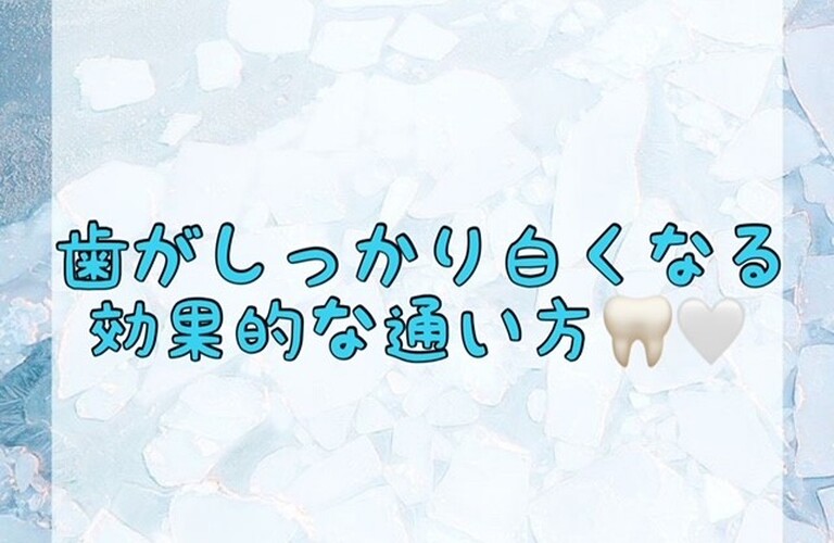 【歯がしっかり白くなる効果的な通い方🦷🤍】