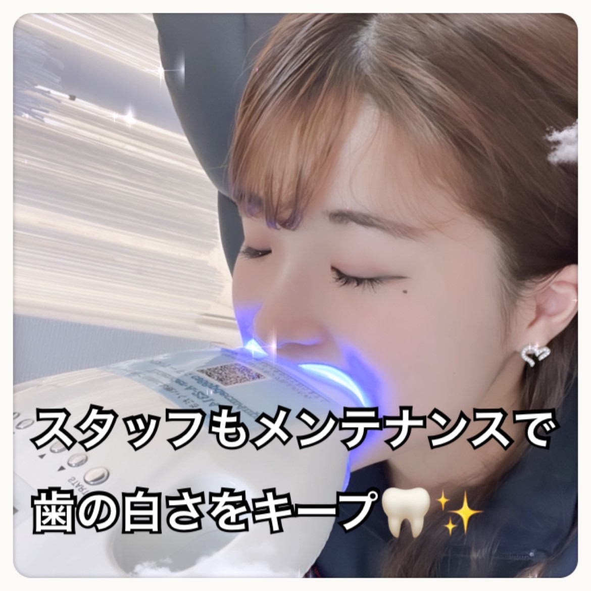 ダウンロード (10)